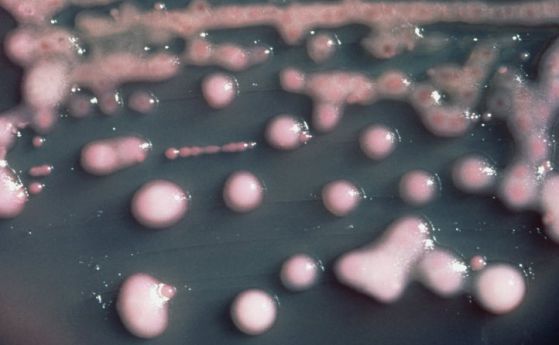 Проучване установи рядък щам супербактерии в Хюстън