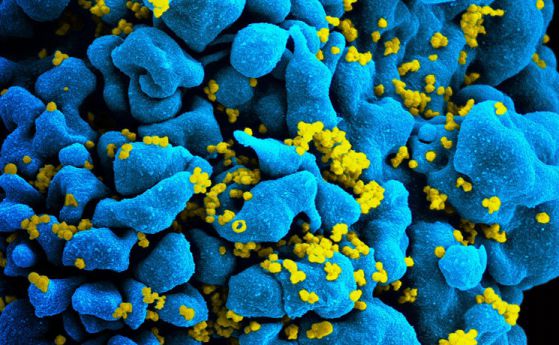 Нови антитела срещу ХИВ са 99% ефективни и работят като ваксини