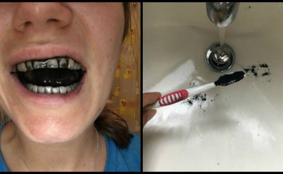 Пастите за зъби с активен въглен носят повече вреда, отколкото полза