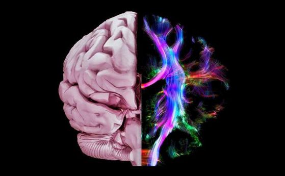 Софийски фестивал на науката: Как работи мозъкът?