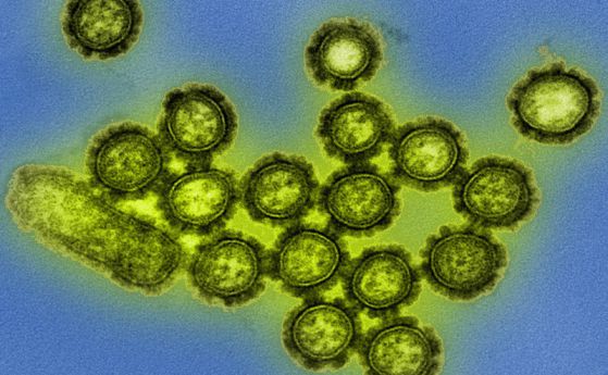 Защо се появяват все повече смъртоносни вирусни епидемии в световен мащаб