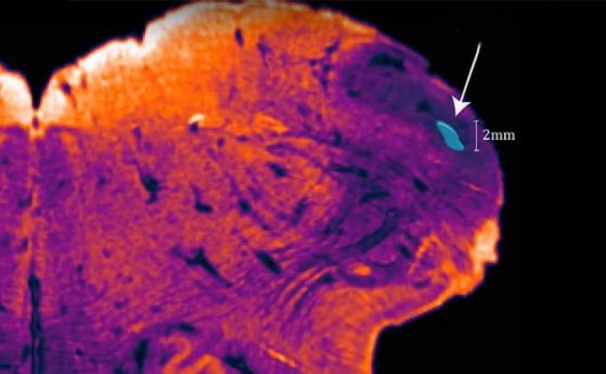 Учени откриха скрита досега област в човешкия мозък