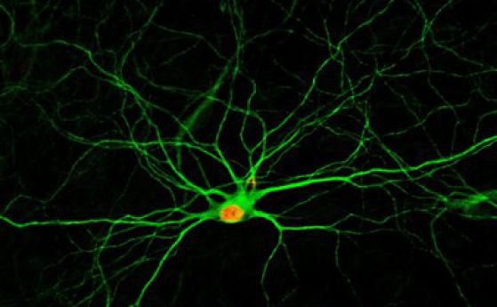Учени създават нови неврони от съседни клетки с проста комбинация от медикаменти