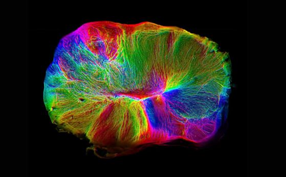 Лабораторно отгледан мозък се свързва сам с гръбначен мозък