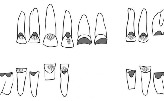 Зъби на жена от Древен Египет показват, че е имала изненадваща професия