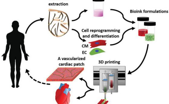 За първи път: цяло 3D принтирано сърце с биологични материали на пациента
