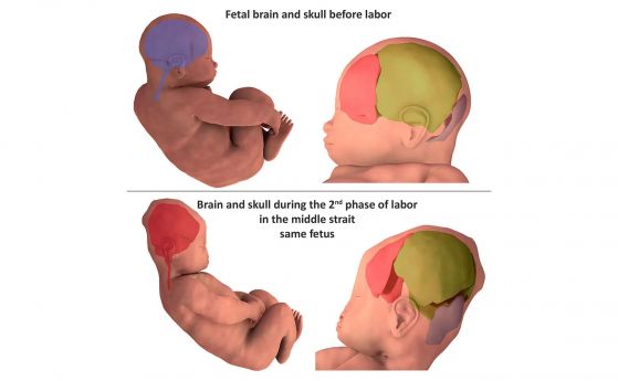 3D сканиране разкрива как главата на бебето променя формата си по време на раждането