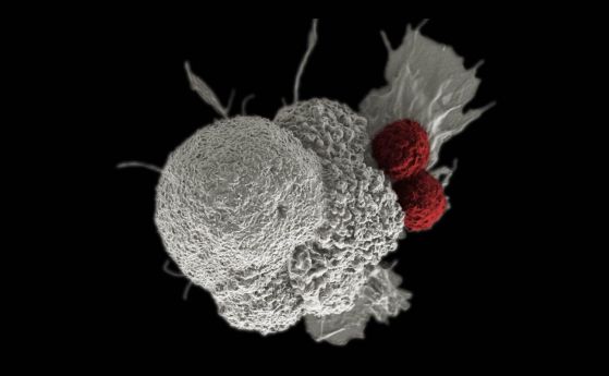 Орален плоскоклетъчен карцином (в бяло) нападнат от две Т-клетки (в червено), част от естествения имунен отговор.