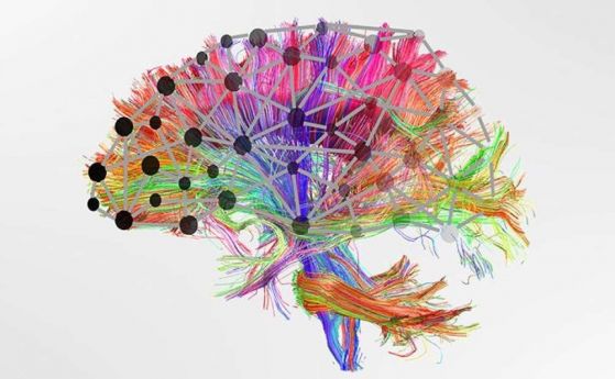 Затрудненията в ученето са свързани с връзките в мозъка, а не със специфични региони от него
