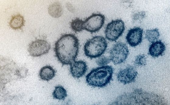 Новият коронавирус се запазва жив на някои повърхности до 3 дена, показват последни тестове