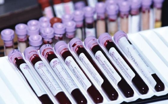 Изследване опровергава теорията, че кръвната група влияе върху риска от COVID