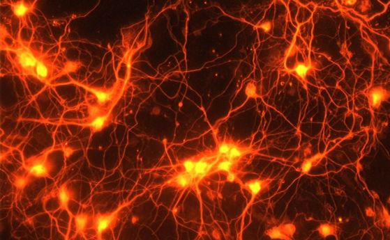 Синтетични неврони използват йони, за да запазят „спомени“, точно както прави мозъкът ни