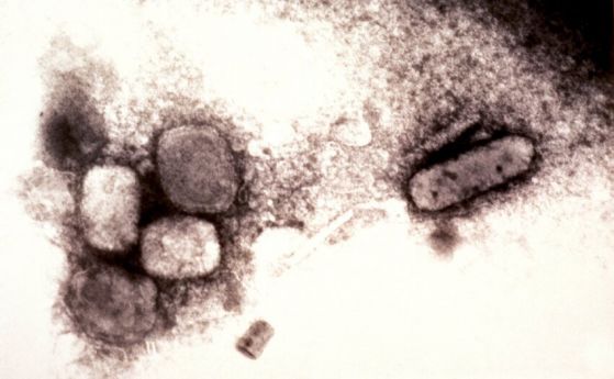 Флакони с надпис "едра шарка" са открити в лаборатория за изследване на ваксини в Пенсилвания