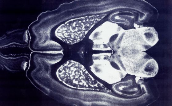 „Неврозърна“, вградени в нервната тъкан, може да са следващите интерфейси мозък-компютър