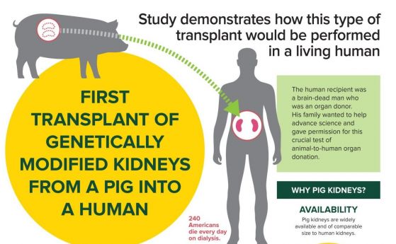 Успешна трансплантация на два бъбрека от генетично модифицирано прасе в човек (видео)