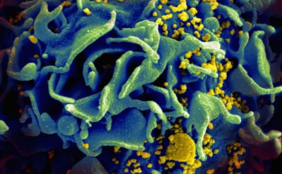 Жена е излекувана от ХИВ след преливане на кръв от пъпна връв