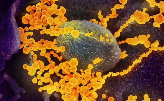 Мистериозният „руски грип“ преди 130 години може да е бил коронавирус, казват учени