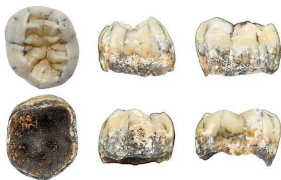 Множество изгледи на детски зъб, открит в пещера в северен Лаос, може да са принадлежали на денисово момиче.