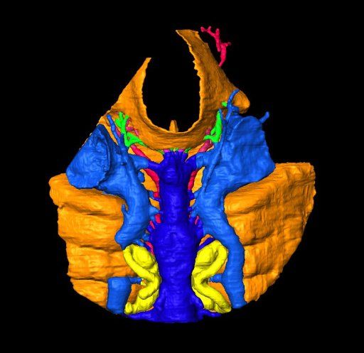 3D виртуална реконструкция на мозъчен корпус Шую