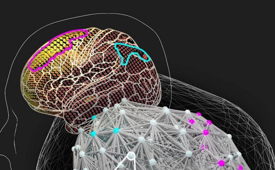 Хората с мозъци, чиито връзки ги правят силно синхронизирани, е по-вероятно да дадат точни отговори, но понякога за сметка на бързината