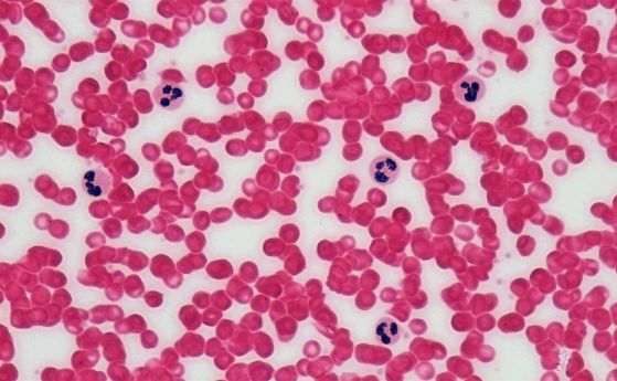 Изображение на червени кръвни клетки и сини лимфоцити.