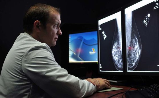 Редовното посещение на мамографски прегледи може да намали риска от смърт от рак на гърдата