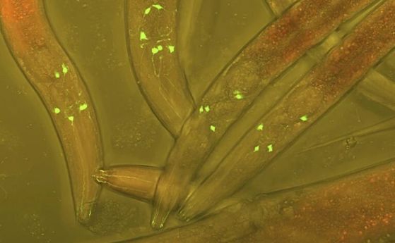Конфокална светлинна микрофотография на червеи Caenorhabditis elegans, експресиращи зелени флуоресцентни протеини, които разкриват неврони.