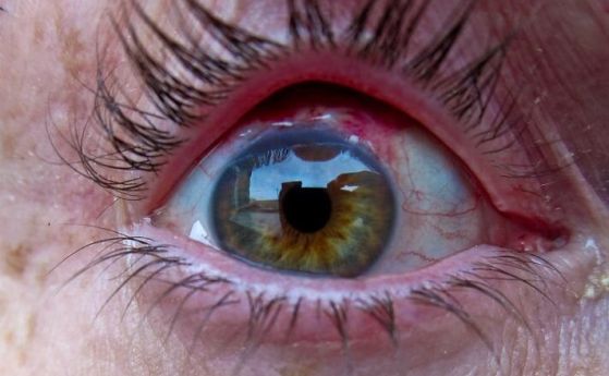 Очите на слепия човек може да са увредени, но зрителната кора на мозъка му все още работи.