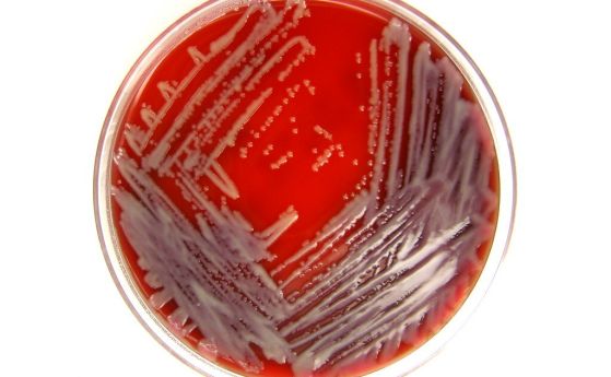 бактериите <em>Stenotrophomonas maltophilia.</em>