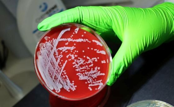 Staphylococcus aureus върху петриева паничка