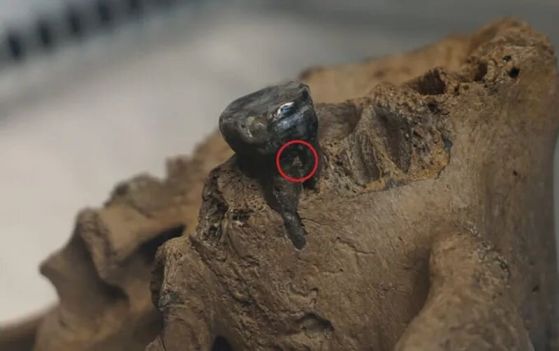 Близък план на древна челюст, в която все още е вграден почернял зъб. Червен кръг отстрани на зъба показва мястото, откъдето изследователите са взели проба за генетично изследване.