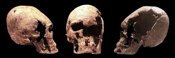 Удължен череп на млада жена, вероятно аланка. Изложен в Историческия музей на Ивърдън.