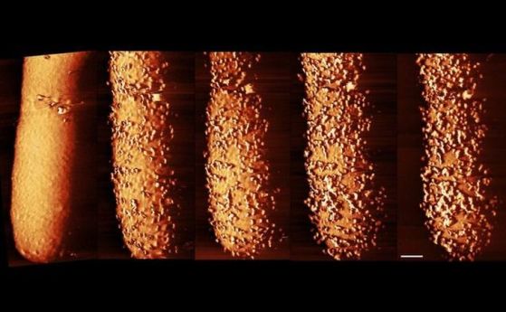 Композитно изображение на E. coli, изложена на антибиотика полимиксин – изображенията показват промените във външния слой на бронята с течение на времето. Отляво надясно: бактерия, нетретирана от антибиотика; бактерия след 15 минути; след 30 минути; след 