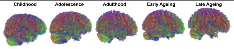 Всички епохи: представителни ЯМР трактографски изображения на всички епохи на човешкия мозък