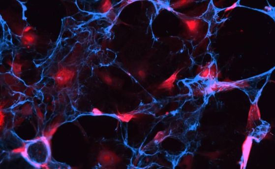 Изображение от конфокална микроскопия показва стареещи клетки (червено), маркирани с молекули, известни като аптамери (синьо).