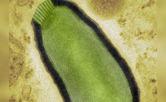 Зелен зомби вирус под микроскоп, на пъстър жълт фон.