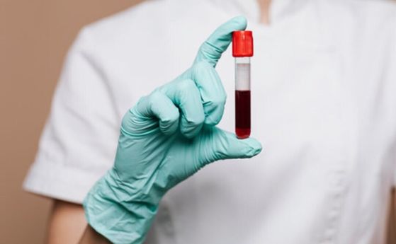 Един кръвен тест може да промени начина, по който се диагностицира болестта на Алцхаймер