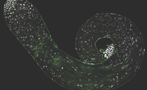 на черен фон зелена спирала пот точки