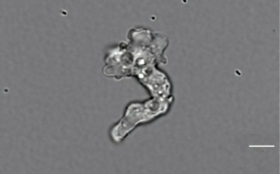Клетка Incendiamoeba cascadensis при 55ºC, мащабна линия 5µm. Кредит: Beryl Rappaport