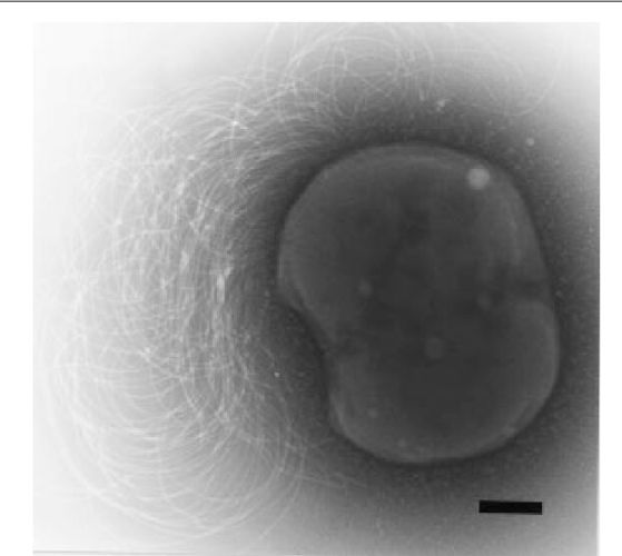 Methanothermococcus okinawensis sp. nov., a thermophilic, methane-producing  archaeon isolated from a Western Pacific deep-sea hydrothermal vent system.  | Semantic Scholar