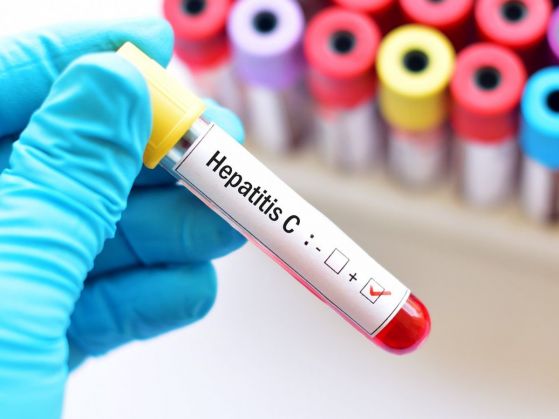 Ново откритие ще ускори създаването на ваксина срещу хепатит С