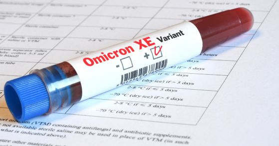 Откриха нова мутация на коронавируса: Omicron XE