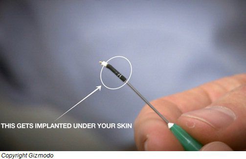 НАСА изобрети животоспасяващ имплант