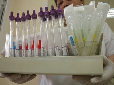 Безплатни тестове за мъже за дефицит на тестостерон