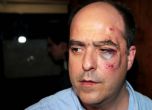 Ранени депутати след бой във венецуелския парламент