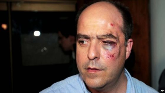 Опозиционерът Хулио Боргес след боя във венецуелския парламент, Снимка: BBC