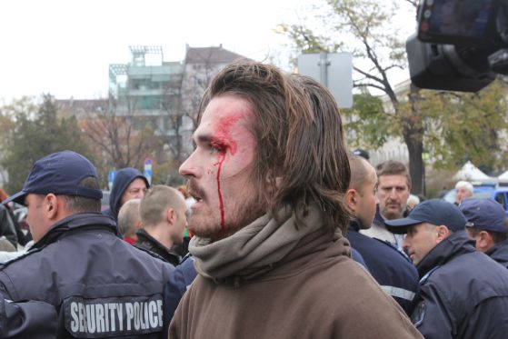 Насилие на обсадата на парламента - полицаи раниха в главата един от протестиращите. 12.11.2013 г. Снимка: Сергей Антонов
