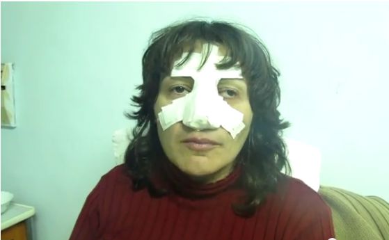 Разказът на жена, бита по неосветените улици на Добрич (видео)