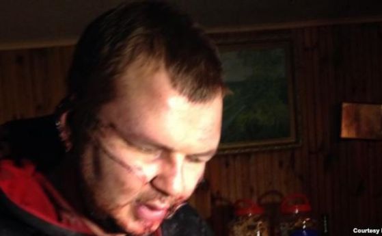 Дмитрий Булатов беше открит с порезни рани по ръцете и лицето. Снимка: Radio Free Europe