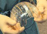 Неврохирурзи успешно трансплантираха 3D череп